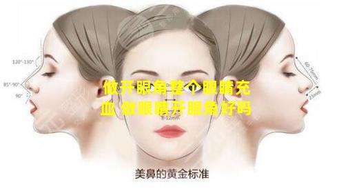 做开眼角整个眼睛充血 做眼睛开眼角好吗